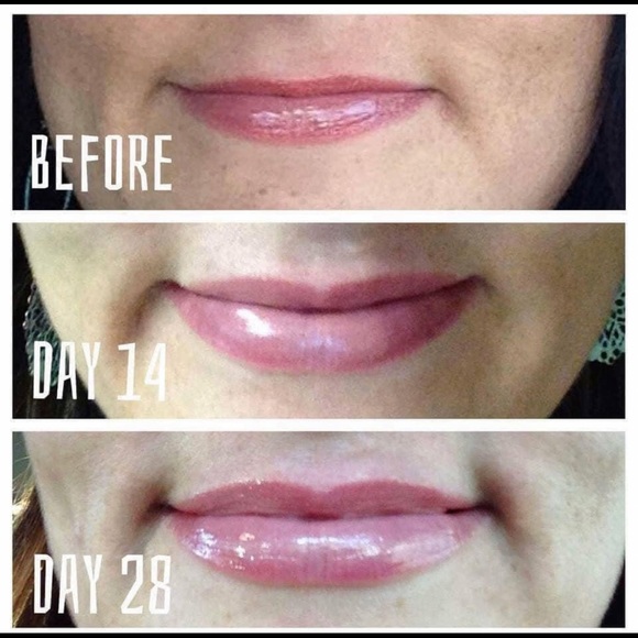 Lip plumping balm - Picture 2 of 3